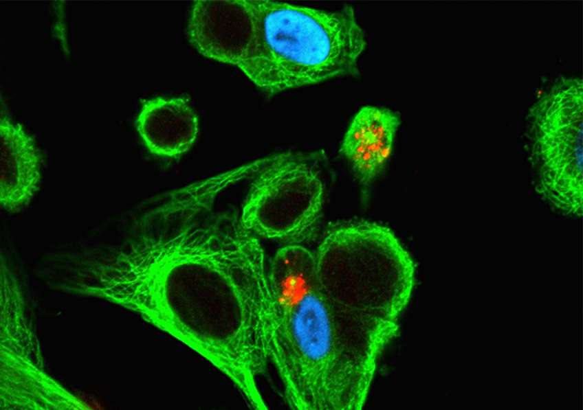 Infection par le cytomégalovirus (CMV), ici chez l’humain. En rouge et vert, les cellules Natural Killer essayent de se frayer un chemin vers la cellule infectée. © Inserm, Jabrane-Ferrat, Nabila